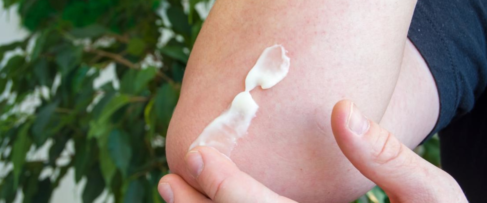 Topical Application: Types, Benefits, and How to Use